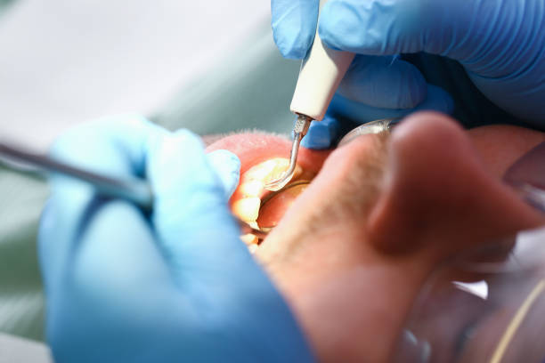 Best Emergency Gum Pain Relief  in Laverne, OK