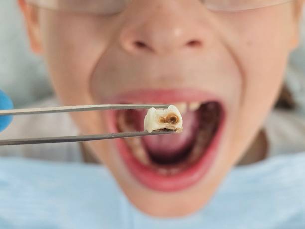 Best Tooth Pain Emergency Relief  in Laverne, OK
